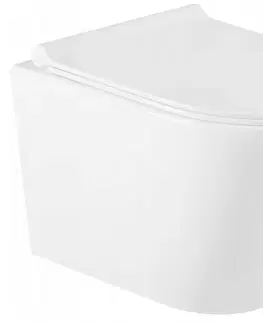 Záchody MEXEN/S Rico Závěsná WC mísa Rimless včetně sedátka s slow-slim, Duroplast, bílá 30720500 30720500