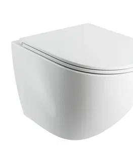 Záchody OMNIRES OTTAWA COMFORT mísa Rimless včetně sedátka s slow, 54 x 37 cm bílá lesk /BP/ OTTAWACMWBP