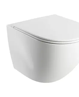 Záchody OMNIRES OTTAWA mísa Rimless včetně sedátka s slow, 49 x 37 cm bílá lesk /BP/ OTTAWAMWBP
